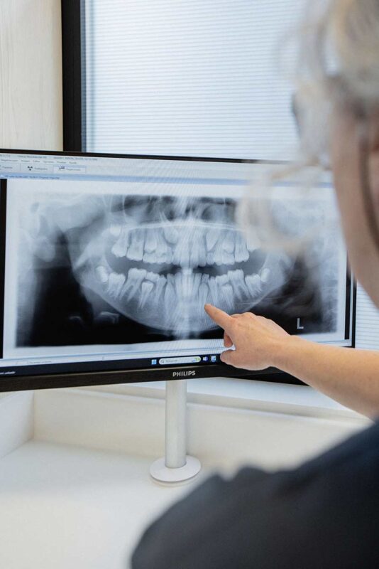 clinica-dental-amadent-amara