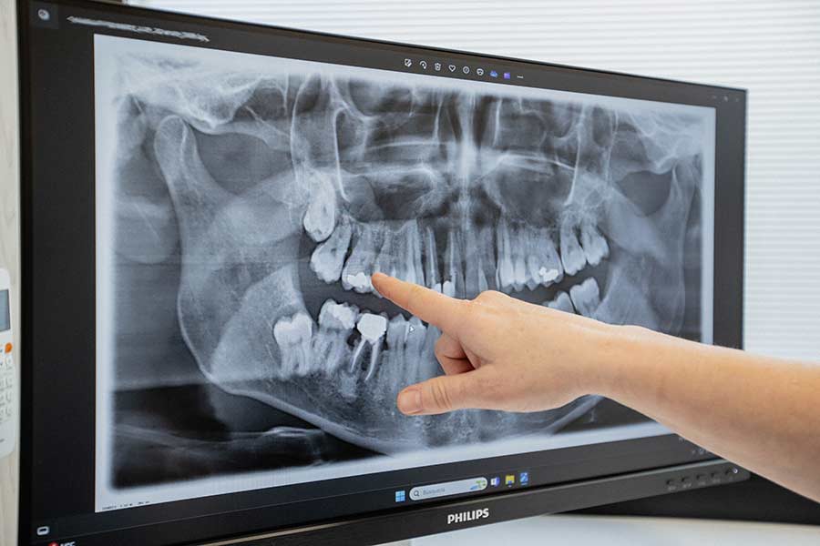 donostia-5-amadent-dentista