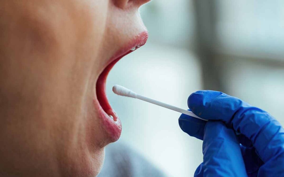 Aftas bucales: qué son, causas y tratamiento en Amadent Donostia