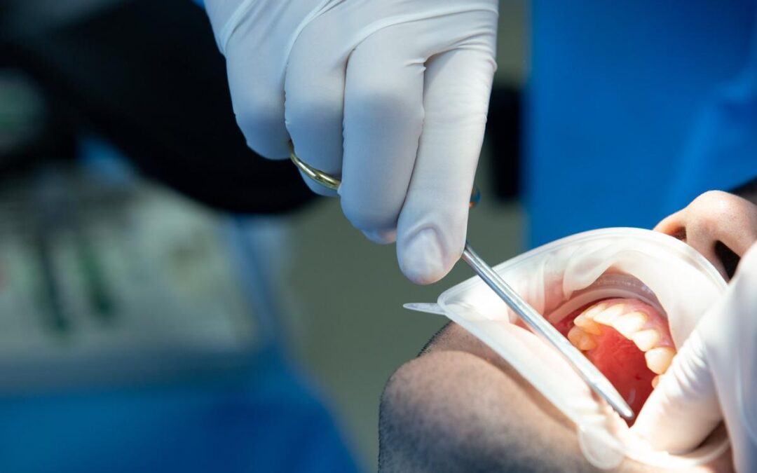 Endodoncia en Donostia: qué es exactamente, cómo se realiza y cuándo es necesaria