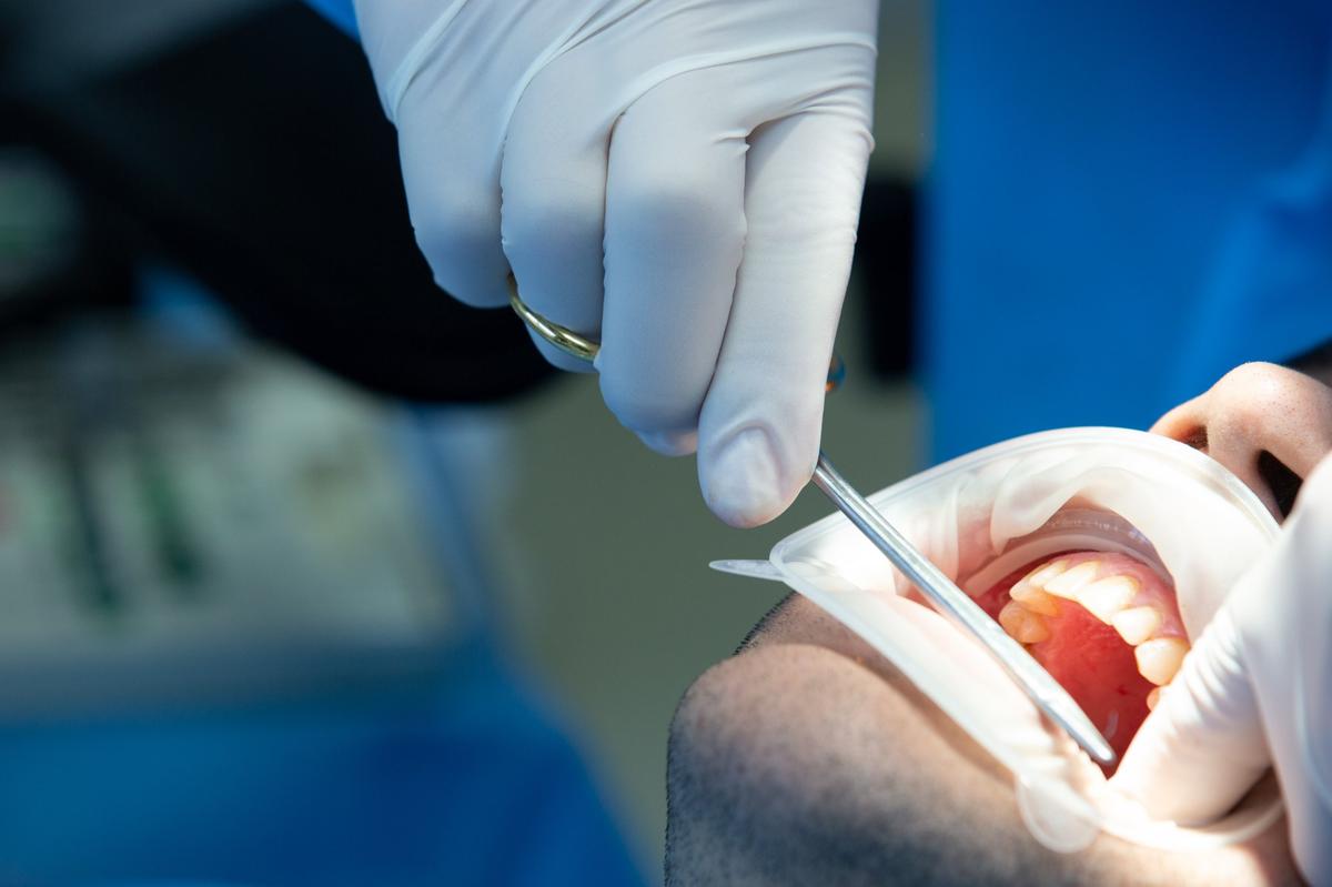 Dentista realizando endodoncia en paciente en clínica Amadent Donostia
