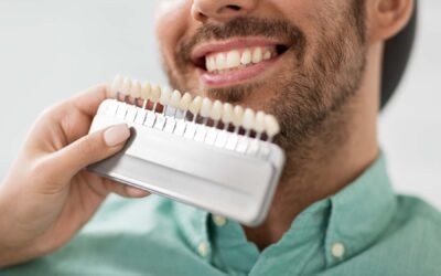 Carillas dentales en Donostia: recupera una sonrisa natural y duradera